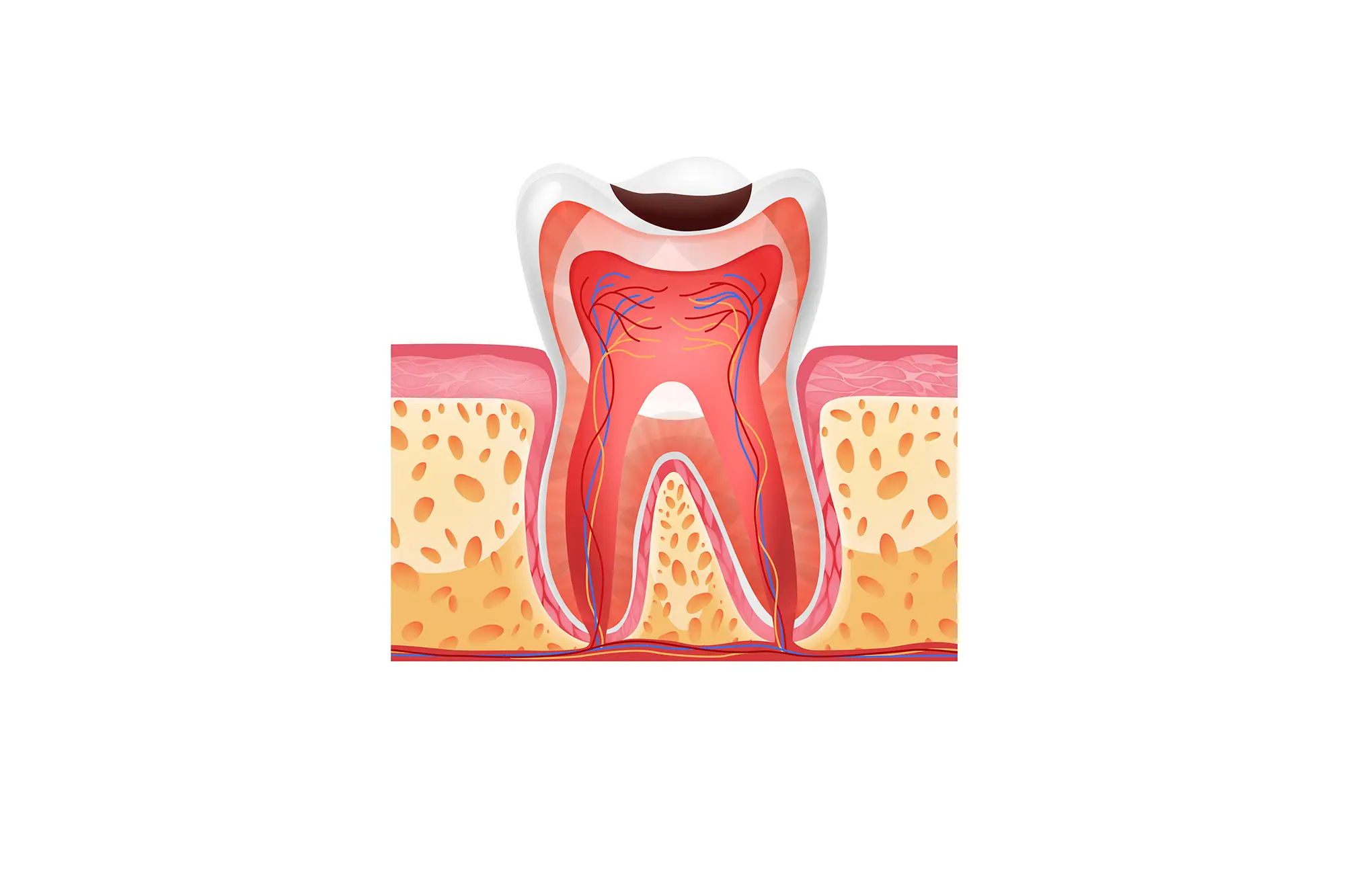 biologichno-lechenie-na-karies
