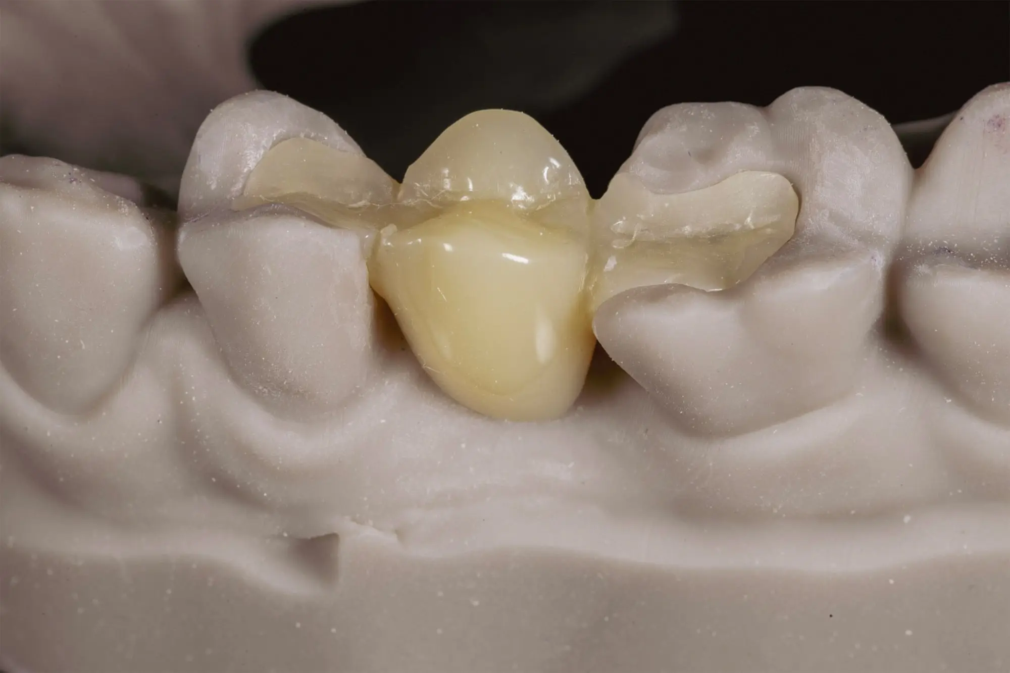 kompoziten most-4-min