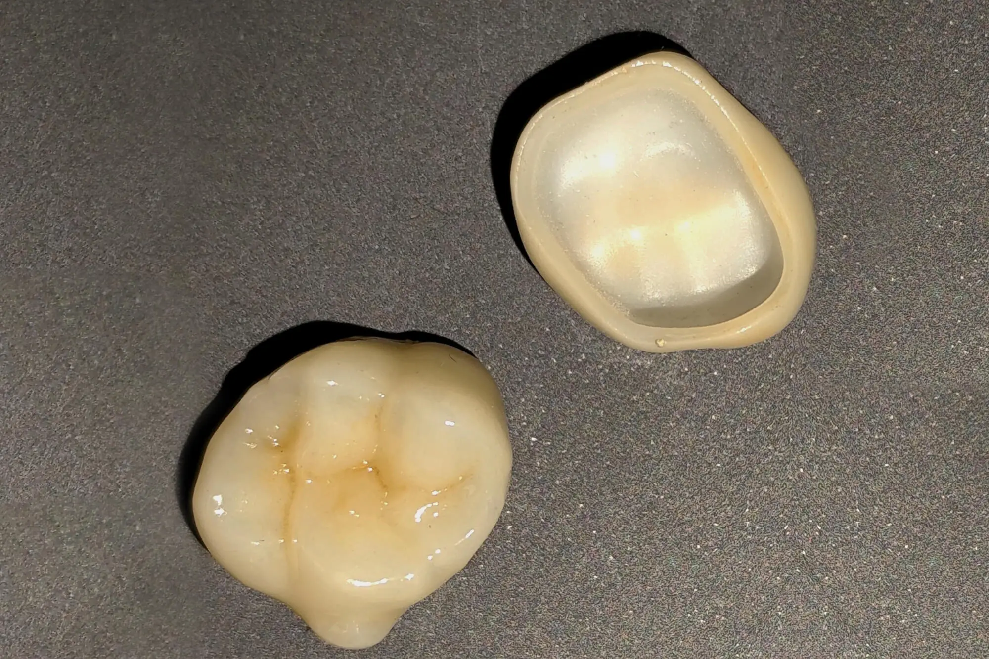 nepodvijno-protezirane-2 (1)